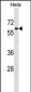 PAF1 Antibody (C-term)