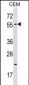 CBX4 Antibody (N-term)