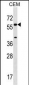 CYP21A2 Antibody (Center)