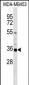 KCNA5 Antibody (C-term)