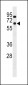 SNRNP70 Antibody (Center)