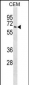 TPP1 Antibody (N-term)