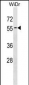 APG4D Antibody (Center S341)