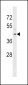 RRM2B Antibody (Center)