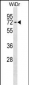 CTNNBL1 Antibody (N-term)