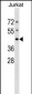 DHPS Antibody (N-term)