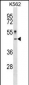 CRLF1 Antibody (Center)