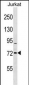 RHOBTB1 Antibody (C-term)