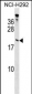 TPPP Antibody (Center)