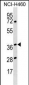 HNRNPH3 Antibody (Center)