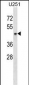 SH3GL1 Antibody (C-term)