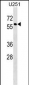 MPI Antibody (N-term)