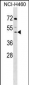 DCPS Antibody (Center)