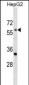 ENC1 Antibody (C-term)