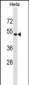 KRR1 Antibody (N-term)