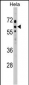 SOCS7 Antibody (C-term)