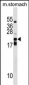 CDC42EP2 Antibody (C-term)