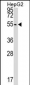CLP1 Antibody (C-term)