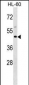 BSG Antibody (Center)