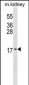 ID3 Antibody (N-term)