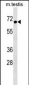 CBX2 Antibody (Center)