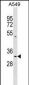 PPT1 Antibody (Center)