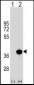 PPT1 Antibody (Center)