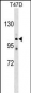 ATP2C1 Antibody (C-term)