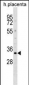 DOK5 Antibody (N-term)