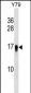 UBE2G1 Antibody (C-term)