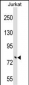 TRIM46 Antibody (N-term)
