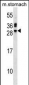 TNNI3 Antibody (Center)