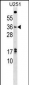 NKX3-1 Antibody (C-term)