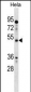 IL13RA1 Antibody (N-term)