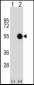 MKRN2 Antibody (N-term)