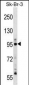 TTK Antibody (N-term)