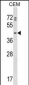 PRKAR1B Antibody (N-term)