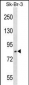 USP10 Antibody (Center)