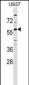 GPR75 Antibody (C-term)