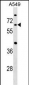 CDC14A Antibody (C-term)