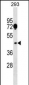 SGCA Antibody (Center)