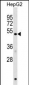 HERPUD1 Antibody (N-term)