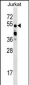 CUGBP2 Antibody (C-term)