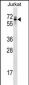 TROVE2 Antibody (C-term)