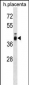 ZP3 Antibody (C-term)