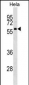 TH1L Antibody (C-term)