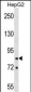 HNRNPR Antibody (N-term)