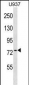 PABPC4 Antibody (Center)