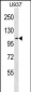 MCC Antibody (Center)