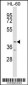 ABTB1 Antibody (C-term)